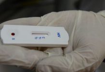 Metas para eliminação da Aids até 2030 podem não ser cumpridas