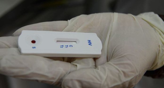 Metas para eliminação da Aids até 2030 podem não ser cumpridas