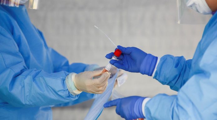Instituto desenvolve teste rápido para detectar covid-19